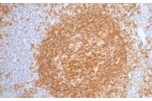 Immunohistochemistry of paraffin-embedded Human tonsil tissue using CD20 Monoclonal Antibody at dilution of 1:200. (CD20 antibody)