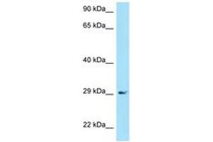 Image no. 1 for anti-B-cell antigen receptor complex-associated protein alpha chain (CD79A) (AA 71-120) antibody (ABIN6748457) (CD79a antibody  (AA 71-120))