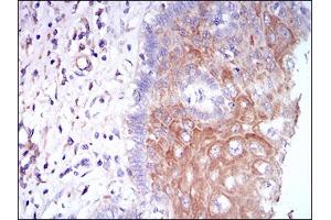 Immunohistochemistry (IHC) image for anti-Colony Stimulating Factor 1 Receptor (CSF1R) (AA 344-497) antibody (ABIN1724925)