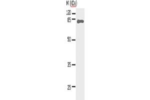 Western Blotting (WB) image for anti-Signal Transducer and Activator of Transcription 5A (STAT5A) antibody (ABIN2427591) (STAT5A antibody)