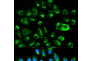 Immunofluorescence analysis of HeLa cells using GAS2 Polyclonal Antibody (GAS2 antibody)