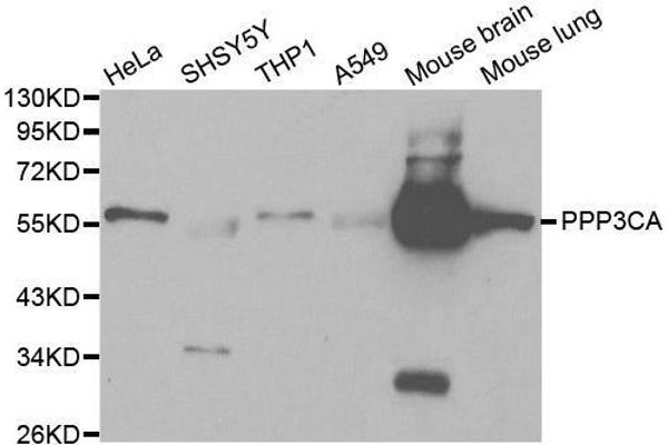 PPP3CA antibody  (AA 1-511)