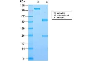 SDS-PAGE (SDS) image for anti-Lectin, Galactoside-Binding, Soluble, 1 (LGALS1) (AA 12-108) antibody (ABIN6939959)