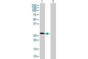 Western Blot analysis of ZNF266 expression in transfected 293T cell line by ZNF266 MaxPab polyclonal antibody. (ZNF266 antibody  (AA 1-263))