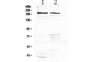 Western blot analysis of Neurocan using anti-Neurocan antibody . (Neurocan antibody)