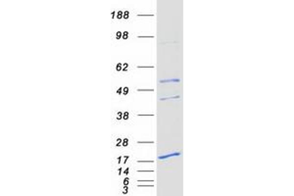 PEMT Protein (Transcript Variant 2) (Myc-DYKDDDDK Tag)