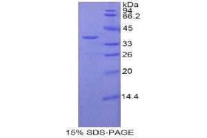 SDS-PAGE (SDS) image for zeta-Chain (TCR) Associated Protein Kinase 70kDa (ZAP70) (AA 270-560) protein (His tag) (ABIN1877290) (ZAP70 Protein (AA 270-560) (His tag))