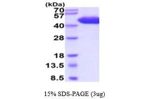 SDS-PAGE (SDS) image for CD5 (CD5) (AA 25-372) protein (His tag) (ABIN5854826) (CD5 Protein (CD5) (AA 25-372) (His tag))