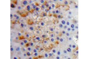 Used in DAB staining on fromalin fixed paraffin-embedded liver tissue (IL17RC antibody  (AA 257-477))