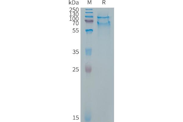 SELPLG Protein (AA 34-356) (His tag)