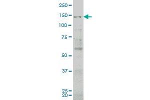 JAG2 monoclonal antibody (M03), clone 4F10 Western Blot analysis of JAG2 expression in COLO 320 HSR . (JAG2 antibody  (AA 121-210))