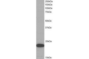 Western Blotting (WB) image for anti-PYD and CARD Domain Containing (PYCARD) (C-Term) antibody (ABIN2465287) (PYCARD antibody  (C-Term))