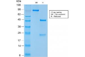 SDS-PAGE Analysis Purified CD56 Rabbit Recombinant Monoclonal Antibody (NCAM1/2217R). (Recombinant CD56 antibody)