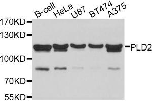 Western blot analysis of extracts of various cell lines, using PLD2 antibody (ABIN4904788) at 1:1000 dilution. (Phospholipase D2 antibody)