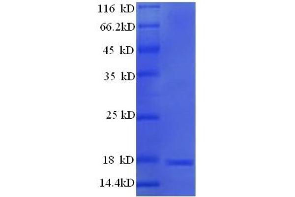 Major Urinary Protein 19 (MUP19) (AA 32-181) protein (His tag)