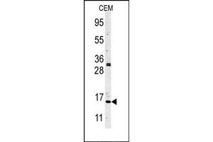 Image no. 1 for anti-Histone 3 (H3) (N-Term) antibody (ABIN356587) (Histone 3 antibody  (N-Term))