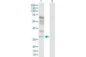 Lane 1: NETO2 transfected lysate ( 17. (NETO2 293T Cell Transient Overexpression Lysate(Denatured))