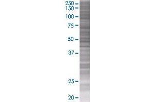 CFHR2 transfected lysate. (CFHR2 293T Cell Transient Overexpression Lysate(Denatured))