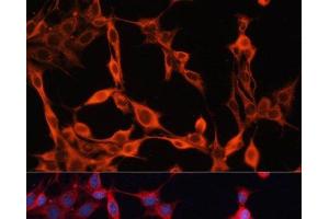 Immunofluorescence analysis of NIH/3T3 cells using SLC25A23 Polyclonal Antibody at dilution of 1:100. (SLC25A23 antibody)