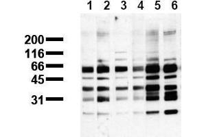 Western Blotting (WB) image for anti-Phosphoserine (phosphorylated) antibody (ABIN126861) (Phosphoserine antibody  (phosphorylated))