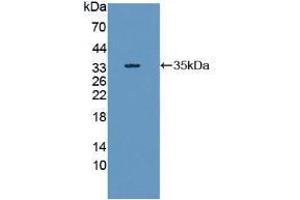 Western blot analysis of recombinant Human RIPK1. (RIPK1 antibody  (AA 17-289))