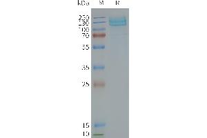 Human -Nanodisc, Flag Tag on SDS-PAGE (GRM7 Protein)