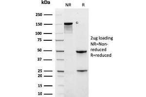 SDS-PAGE Analysis Purified KRT6A Recombinant Mouse Monoclonal Antibody (rKRT6A/2100). (Recombinant KRT6A antibody)