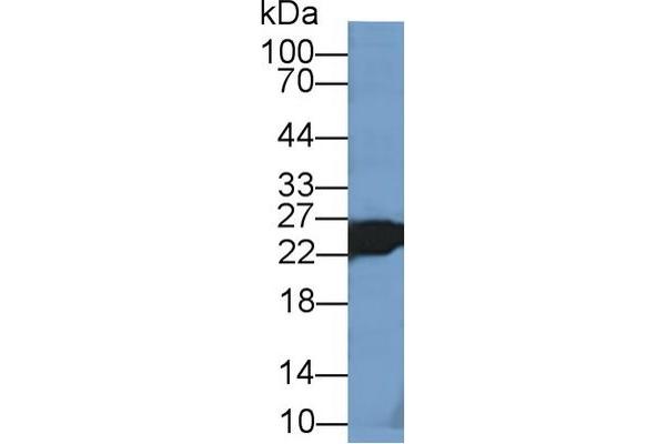 TNNI2 anticorps  (AA 1-182)