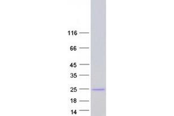 EXOSC3 Protein (Transcript Variant 2) (Myc-DYKDDDDK Tag)