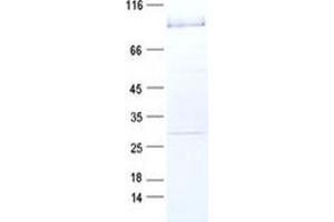 Validation with Western Blot (RIPK3 Protein (GST tag))