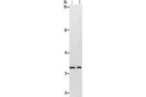 Gel: 8 % SDS-PAGE, Lysate: 40 μg, Lane 1-2: Mouse liver tissue, SP20 cells, Primary antibody: ABIN7128119(ABCB6 Antibody) at dilution 1/320, Secondary antibody: Goat anti rabbit IgG at 1/8000 dilution, Exposure time: 1 minute (ABCB6 antibody)