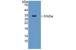 Detection of Recombinant ANGPT2, Rabbit using Polyclonal Antibody to Angiopoietin 2 (ANGPT2) (Angiopoietin 2 antibody  (AA 230-487))