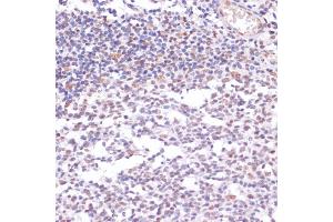 Immunohistochemistry of paraffin-embedded human tonsil using Acetyl-Histone H3-K23 antibody (ABIN7267669) at dilution of 1:100 (40x lens). (Histone 3 antibody  (H3K23))