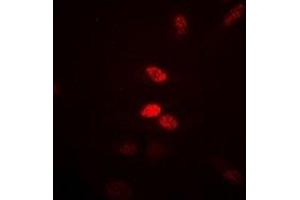 Immunofluorescent analysis of Visfatin staining in Hela cells. (NAMPT antibody)