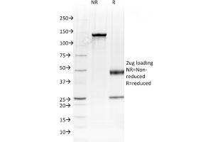 SDS-PAGE Analysis Purified Albumin Mouse Monoclonal Antibody (ALB/2144). (Albumin antibody)