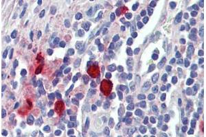 Tonsil, mast cells, Human: Formalin-Fixed, Paraffin-Embedded (FFPE) (CMA1 antibody  (AA 96-110))