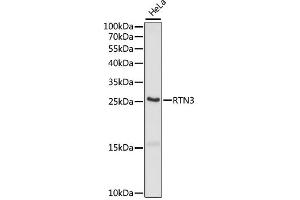 Western blot analysis of extracts of HeLa cells, using RTN3 antibody (ABIN6291193) at 1:1000 dilution. (Reticulon 3 antibody)