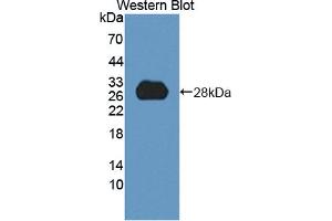 Western blot analysis of the recombinant protein. (HDLBP antibody  (AA 158-371))