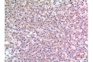 Immunohistochemical analysis of paraffin-embedded human-liver, antibody was diluted at 1:100. (CMTM6 antibody  (C-Term))