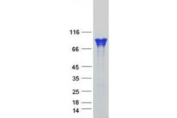 CTNNA1 Protein (Myc-DYKDDDDK Tag)