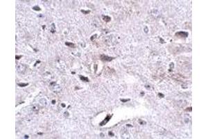 Immunohistochemistry (IHC) image for anti-Leucine Rich Repeat and Fibronectin Type III Domain Containing 3 (LRFN3) (Middle Region) antibody (ABIN1030988) (LRFN3 antibody  (Middle Region))