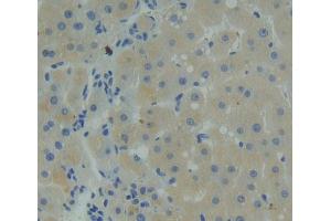 Figure. (Sclerostin antibody  (AA 25-213))