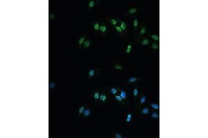 Immunofluorescence analysis of U-2 OS cells using TDP-43/TARDB Polyclonal Antibody (ABIN7270731) at dilution of 1:100 (40x lens). (TARDBP antibody  (AA 1-260))