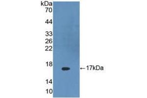 Western blot analysis of recombinant Human DKK4. (DKK4 antibody  (AA 107-212))