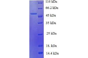 SDS-PAGE (SDS) image for MDH (AA 2-312) protein (His tag) (ABIN5709921) (MDH (AA 2-312) protein (His tag))