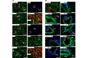 Immunofluorescence (Cultured Cells) (IF (cc)) image for anti-Vimentin (VIM) antibody (ABIN2854814)