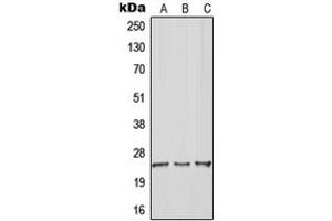 Western blot analysis of RhoGDI gamma expression in Jurkat (A), MCF7 (B), Raw264. (ARHGDIG antibody  (Center))