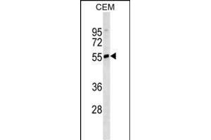 IGHD Antibody (N-term)(Ascites) ABIN1539994 western blot analysis in CEM cell line lysates (35 μg/lane). (IgD antibody  (N-Term))