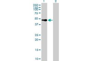 Western Blot analysis of VDR expression in transfected 293T cell line by VDR MaxPab polyclonal antibody. (Vitamin D Receptor antibody  (AA 1-427))