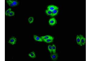 Immunofluorescence staining of HepG2 cells with ABIN7167891 at 1:100, counter-stained with DAPI. (RECK antibody  (AA 23-212))